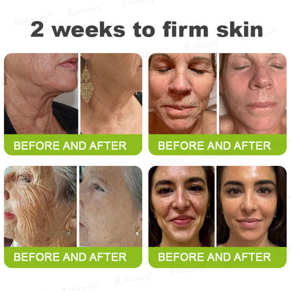 🌿Made and shipped from the USA 💫Rolimey® Botox & Vita-A Retinol Shot Wrinkle-Lift Tightening cream - Last Day Promotion 70% OFF