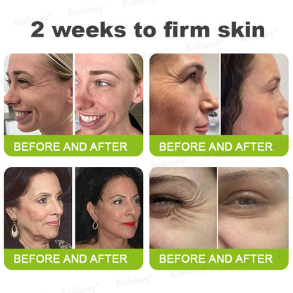 🌿Made and shipped from the USA 💫Rolimey® Botox & Vita-A Retinol Shot Wrinkle-Lift Tightening cream - Last Day Promotion 70% OFF