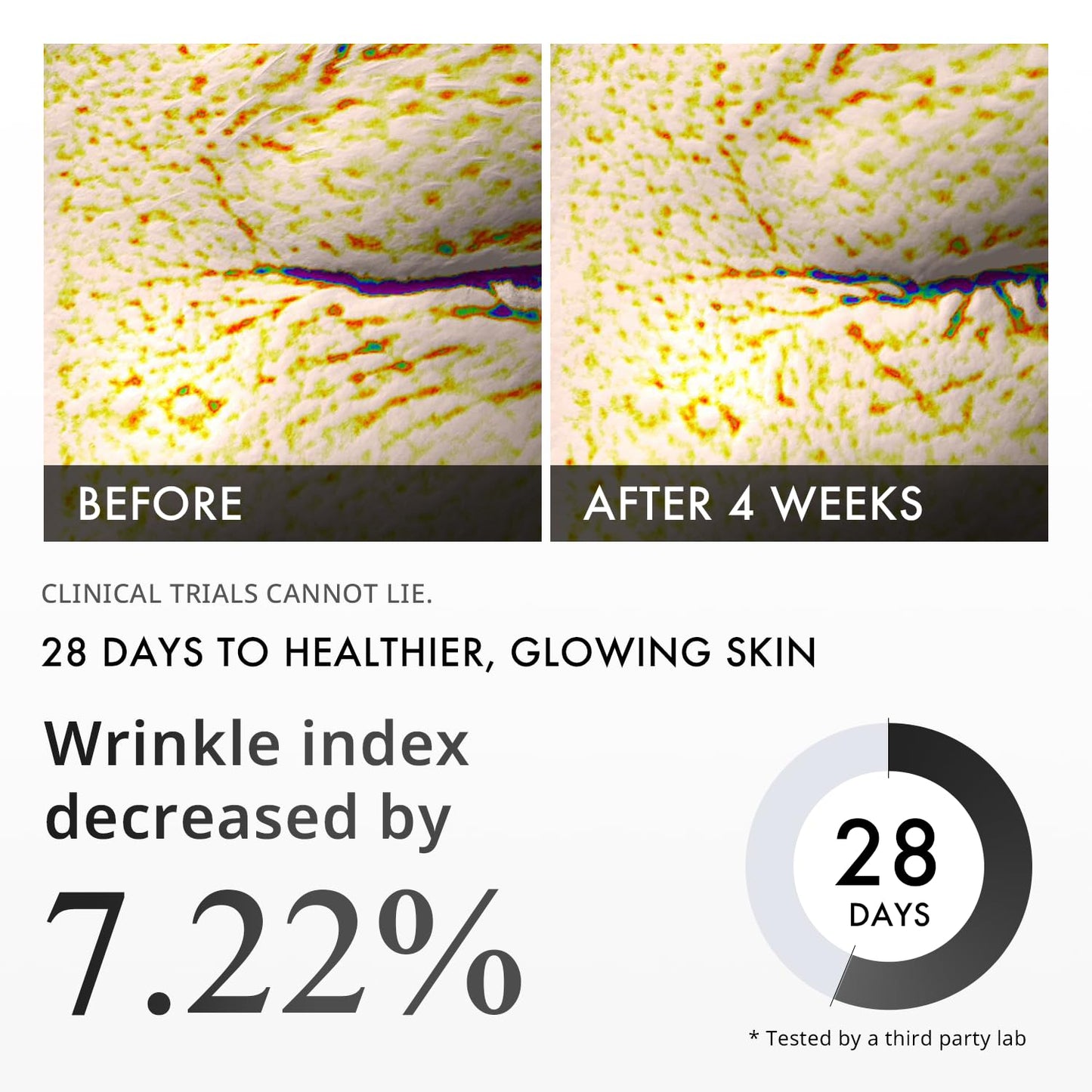 Last 3 Hours 60% OFF🔥 BUY 2 GET 2 FREE🔥SONGBOON Editor Glass Skin Collagen Volufiline Cream-in-Serum | Gentle, Nourishing &Comfort Korean Skincare Moisturizer for Firming & Hydrating