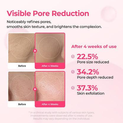 Shrinks Pores & Fades Blemish Marks