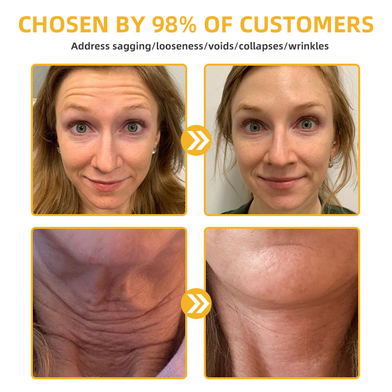 Flysmus™ BeeLift Anti-Aging Firming Cream,Address Crepe & Sagging(🔥74% Off for a Limited Time!)