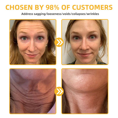 Flysmus™ BeeLift Anti-Aging Firming Cream,Address Crepe & Sagging(🔥74% Off for a Limited Time!)