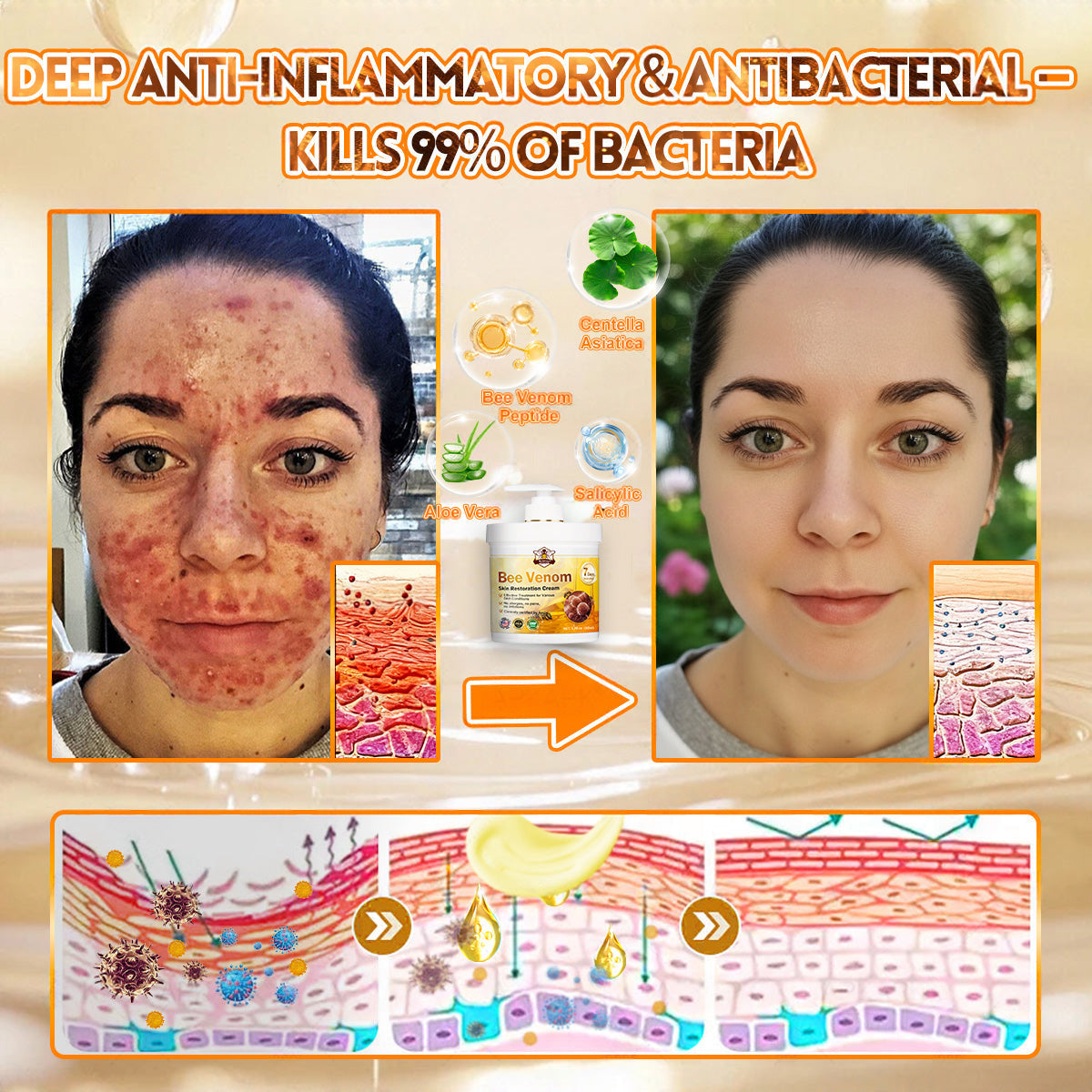 FDA Approved|Rolimey® Bee Venom Skin Restoration Cream (Anti-aging, Hydrating, Skin Repair, Even Tone, Acne and Dark Spot Treatment, Wart and Mole Removal, Psoriasis Relief)