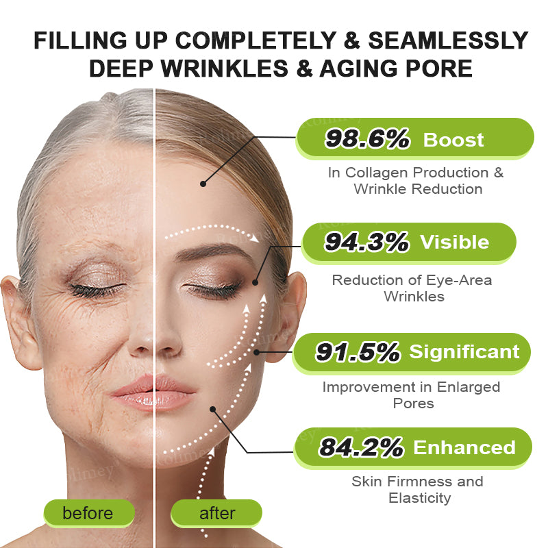 Rolimey® Botox & Vita-A Retinol Shot Wrinkle-Lift Tightening cream - Last Day Promotion 70% OFF