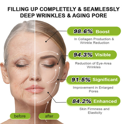 🌿Made and shipped from the USA 💫Rolimey® Botox & Vita-A Retinol Shot Wrinkle-Lift Tightening cream - Last Day Promotion 70% OFF