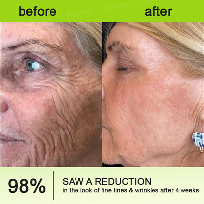 🌿Made and shipped from the USA 💫Rolimey® Botox & Vita-A Retinol Shot Wrinkle-Lift Tightening cream - Last Day Promotion 70% OFF
