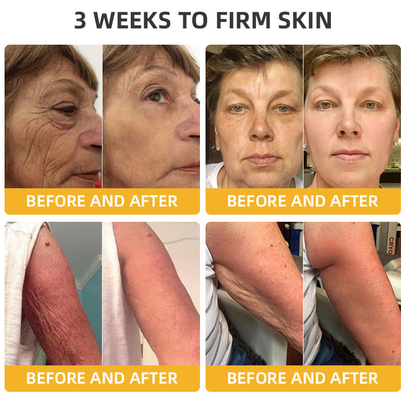 Flysmus™ BeeLift Anti-Aging Firming Cream,Address Crepe & Sagging(🔥74% Off for a Limited Time!)