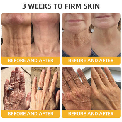 Flysmus™ BeeLift Anti-Aging Firming Cream,Address Crepe & Sagging(🔥74% Off for a Limited Time!)