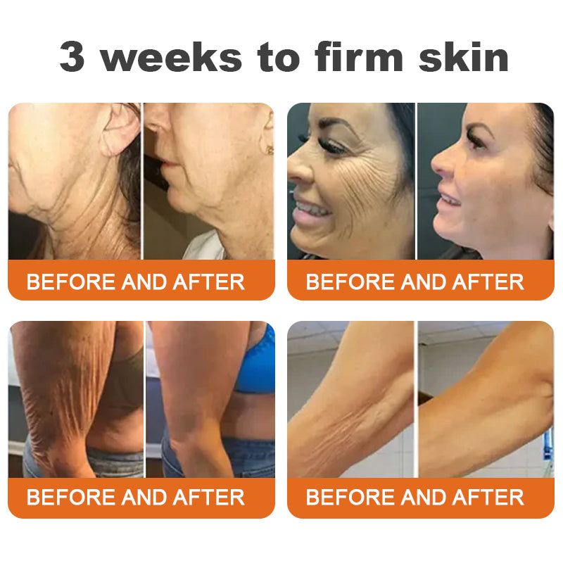 Made and Shipped from USA✨Flysmus™ Botox Bee Venom Firming Serum Stick🔥LAST DAY 70% OFF (Copy)