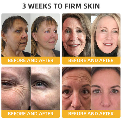 Flysmus™ BeeLift Anti-Aging Firming Cream,Address Crepe & Sagging(🔥74% Off for a Limited Time!)