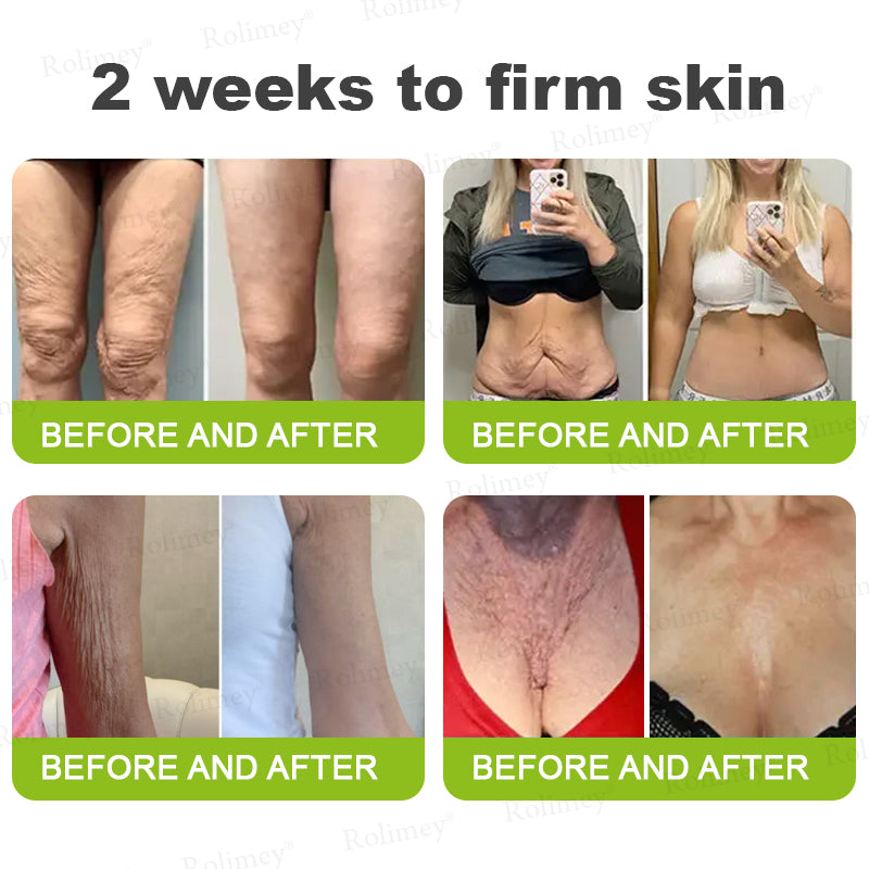 🌿Made and shipped from the USA 💫Rolimey® Botox & Vita-A Retinol Shot Wrinkle-Lift Tightening cream - Last Day Promotion 70% OFF
