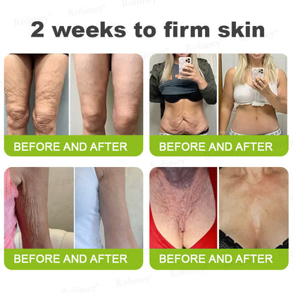 🌿Made and shipped from the USA 💫Rolimey® Botox & Vita-A Retinol Shot Wrinkle-Lift Tightening cream - Last Day Promotion 70% OFF