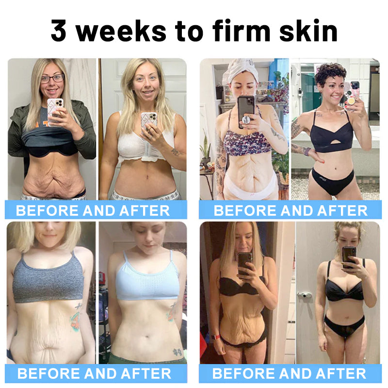 Flysmus™ Collagen Peptides FIRMING SERUM