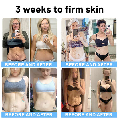 Flysmus™ Collagen Peptides FIRMING SERUM