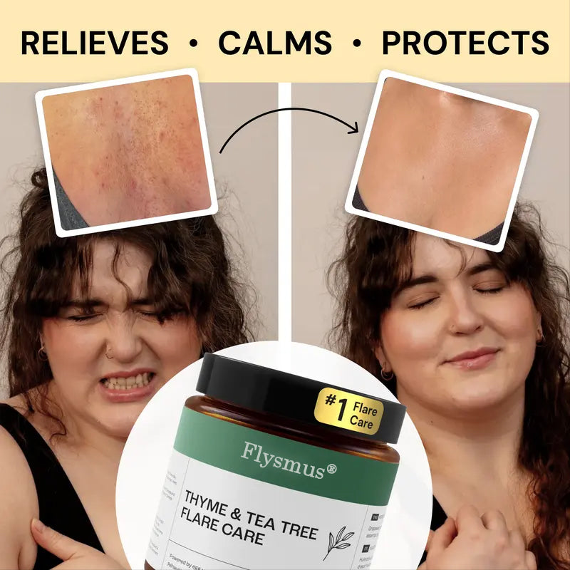 Flysmus®Tea Tree Flare Care| Cystic Acne and Bumps Treatment  Skincare Daily Pimple