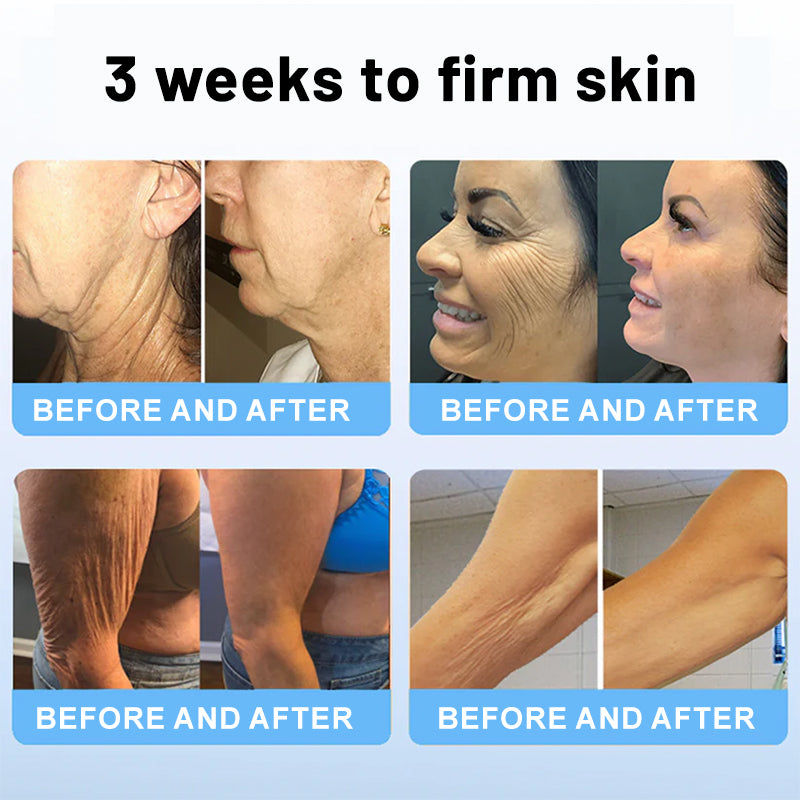 Flysmus™ Collagen Peptides FIRMING SERUM