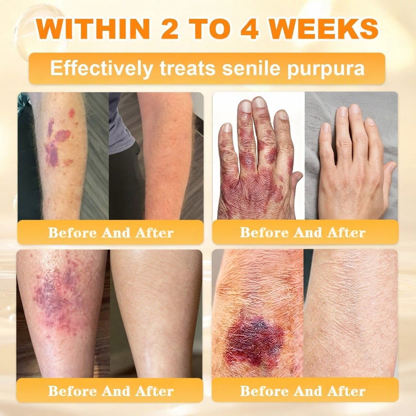 FDA Approved|Rolimey® Bee Venom Skin Restoration Cream (Anti-aging, Hydrating, Skin Repair, Even Tone, Acne and Dark Spot Treatment, Wart and Mole Removal, Psoriasis Relief)