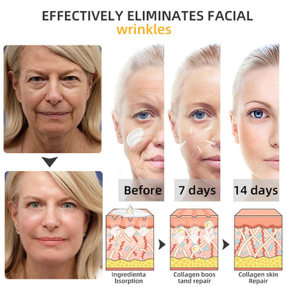 Flysmus™ BeeLift Anti-Aging Firming Cream,Address Crepe & Sagging(🔥74% Off for a Limited Time!)