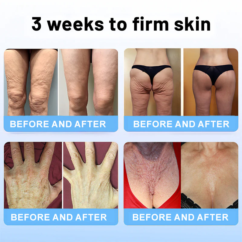 Flysmus™ Collagen Peptides FIRMING SERUM