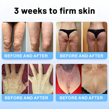 Flysmus™ Collagen Peptides FIRMING SERUM