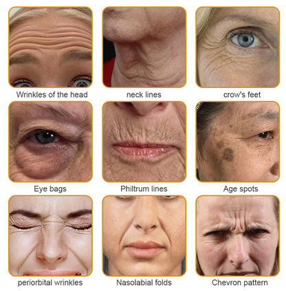 Made and Shipped from the USA✅ Furzero™ Botox Bee Venom Wrinkle Removal Cream-Last Day Promotion 70% OFF UPSELL