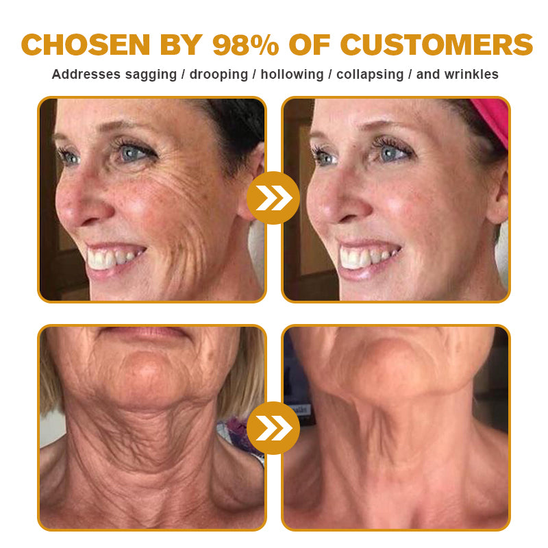 Made and Shipped from the USA✅ Furzero™ Botox Bee Venom Wrinkle Removal Cream-Last Day Promotion 70% OFF UPSELL