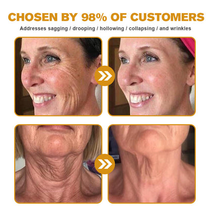 Made and Shipped from the USA✅ Furzero™ Botox Bee Venom Wrinkle Removal Cream-Last Day Promotion 70% OFF UPSELL