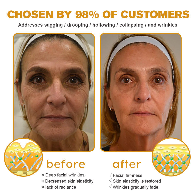 Made and Shipped from the USA✅ Furzero™ Botox Bee Venom Wrinkle Removal Cream-Last Day Promotion 70% OFF UPSELL
