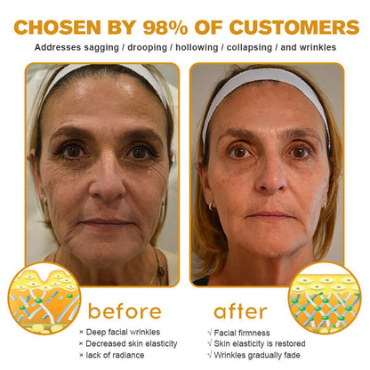 Made and Shipped from the USA✅ Furzero™ Botox Bee Venom Wrinkle Removal Cream-Last Day Promotion 70% OFF UPSELL