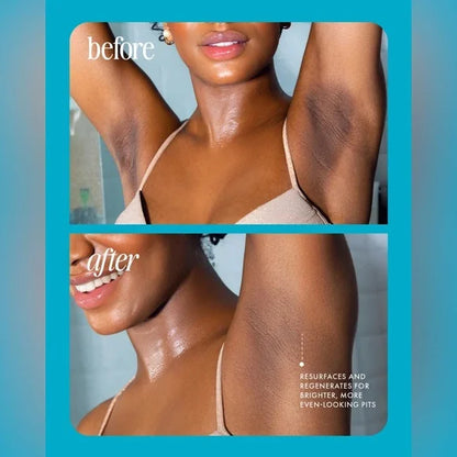 5-Second Post-Hair Removal Rescue: Bumps Fade, Skin Glows! Glass Smooth Oil